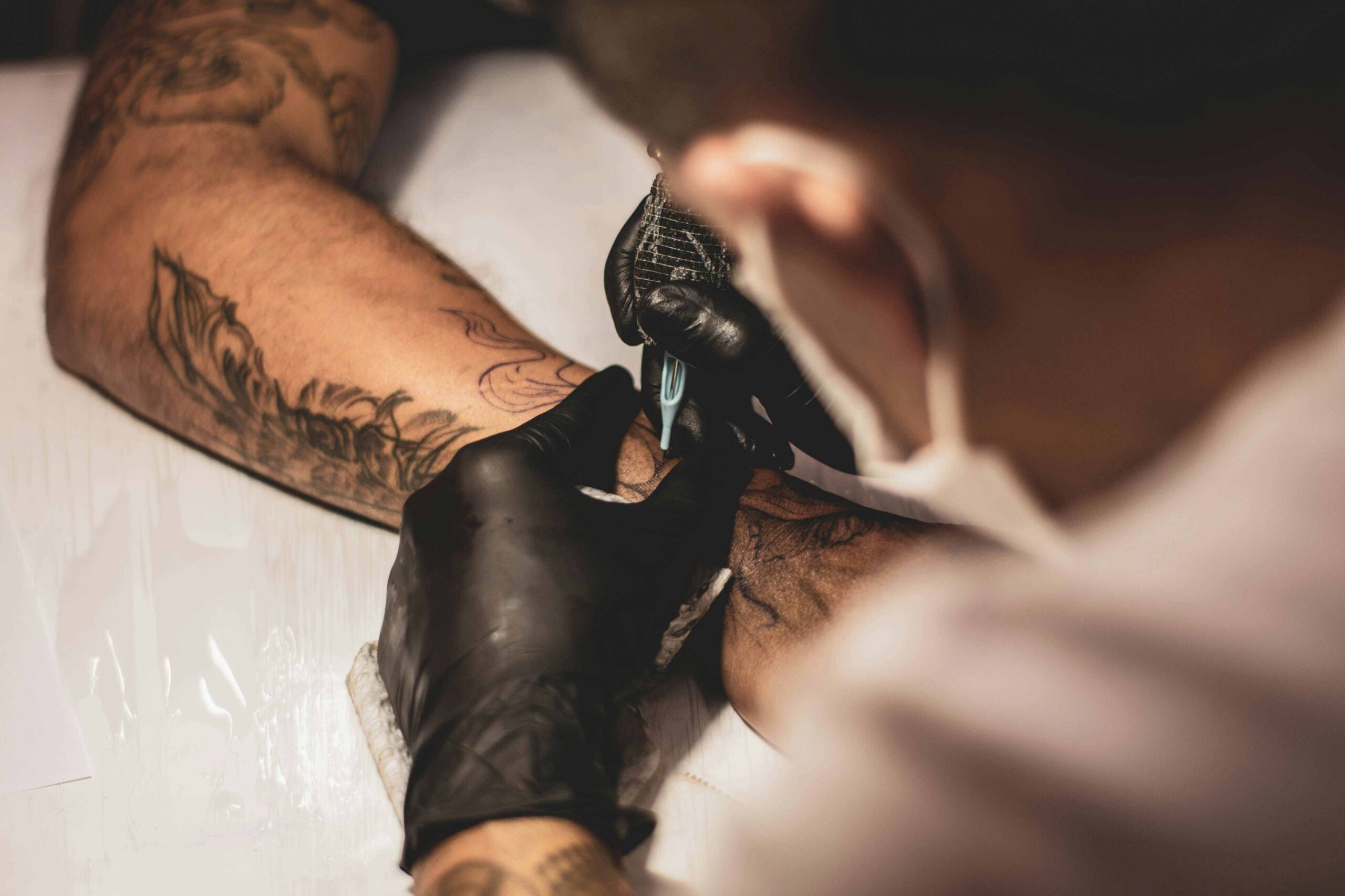 tattoo laser removal machines