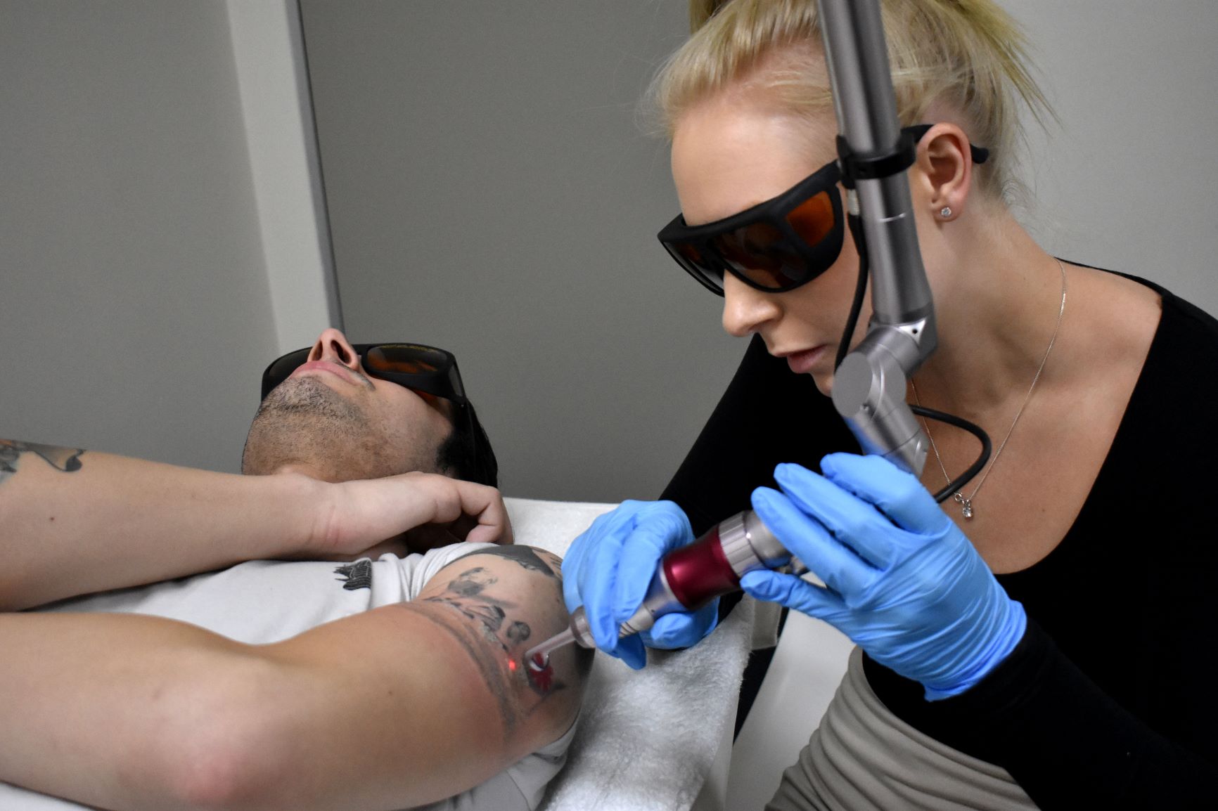 tattoo laser removal machines